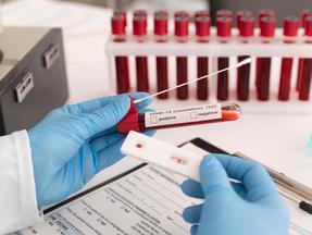 Profissional segura amostra de sangue e teste rápido de Covid
