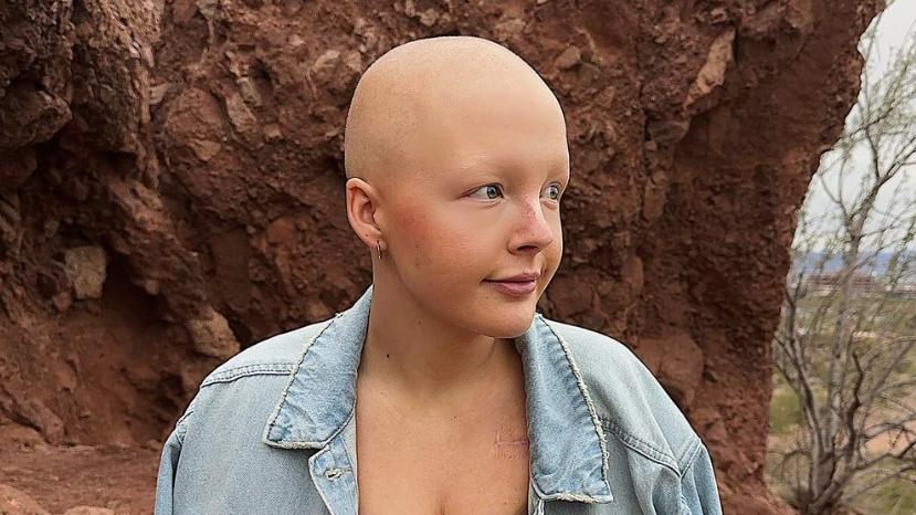 Aos 26 anos, morre Maddy Baloy, TikToker que compartilhava sua batalha contra o câncer terminal