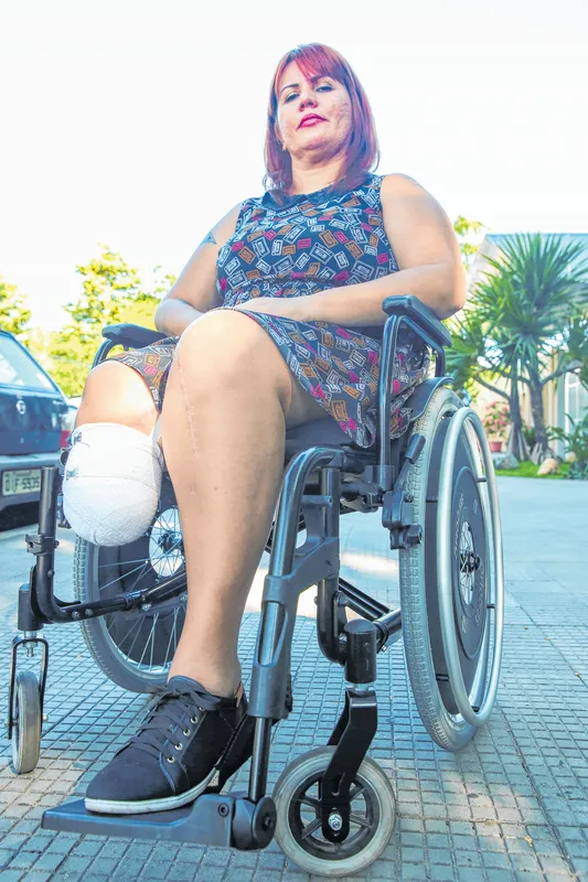 A produtora cultural Luana Holanda teve a rotina transformada há pouco mais de seis meses, quando foi atropelada por um ônibus