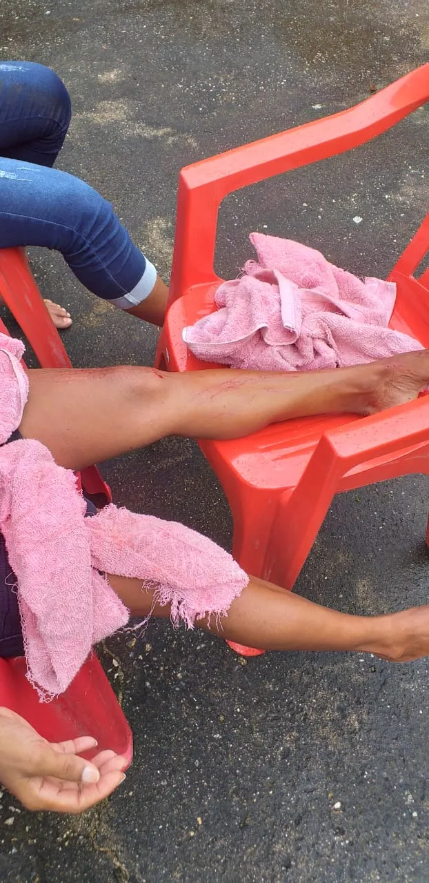 Pessoas ficam feridas após píer desabar na Barra do Ceará