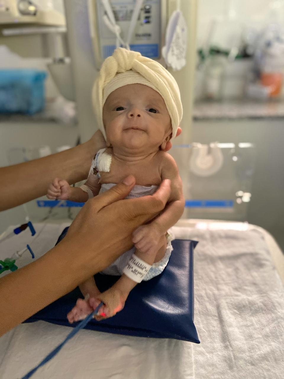 O Amor Chegou Mais Cedo Bebe Prematura Recebe Alta Apos 6 Meses Internada Com Hidrocefalia Regiao Diario Do Nordeste