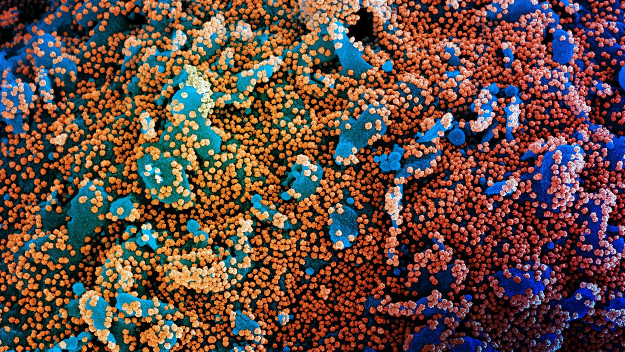 Ceará ultrapassa a marca de 100 mil infectados e está próximo de 6 mil mortos