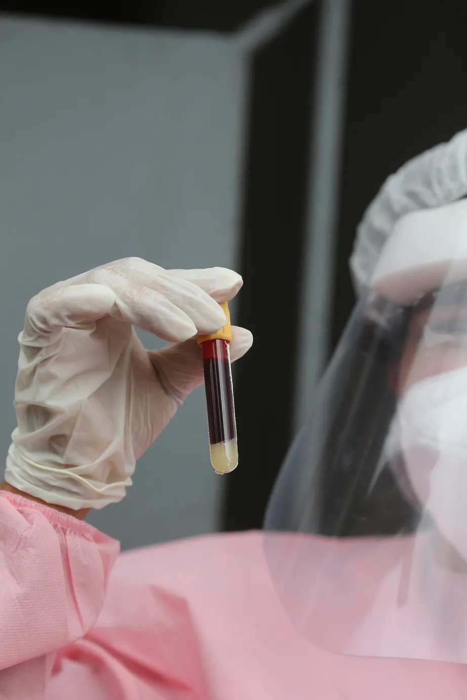 Banco de informações terá amostras de swab respiratório de nariz e boca, soro, sangue e extratos de células