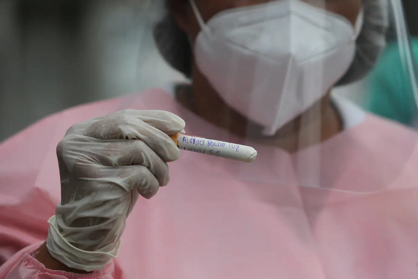 Diagnóstico Covid-19 em profissionais da saúde