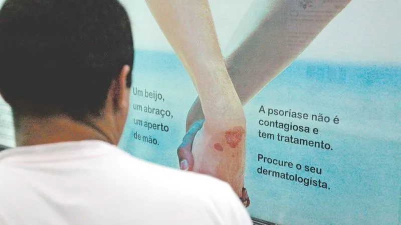 A hanseníase tem cura e o tratamento está disponível no Sistema Único de Saúde (SUS)