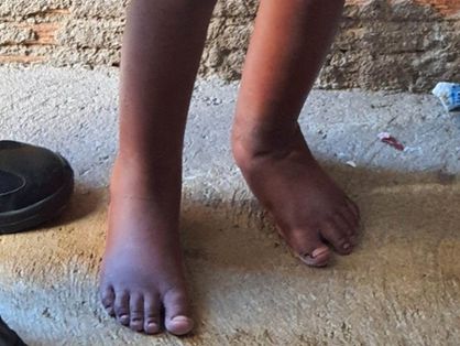 Criança de 11 anos acorrentada em Campinas