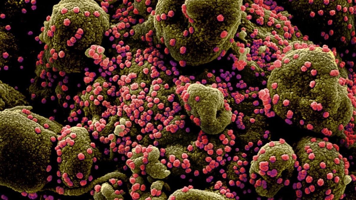 Coronavírus atacando células em imagem de microscópio