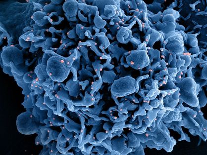Micrografia eletrônica de varredura colorida de uma célula (azul) infectada com partículas do vírus SARS-CoV-2 (rosa), isolada de uma amostra de paciente. Imagem capturada no Centro de Pesquisa Integrada (IRF) do NIAID em Fort Detrick, Maryland