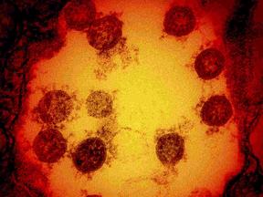 foto de infecção do coronavírus por microscópio