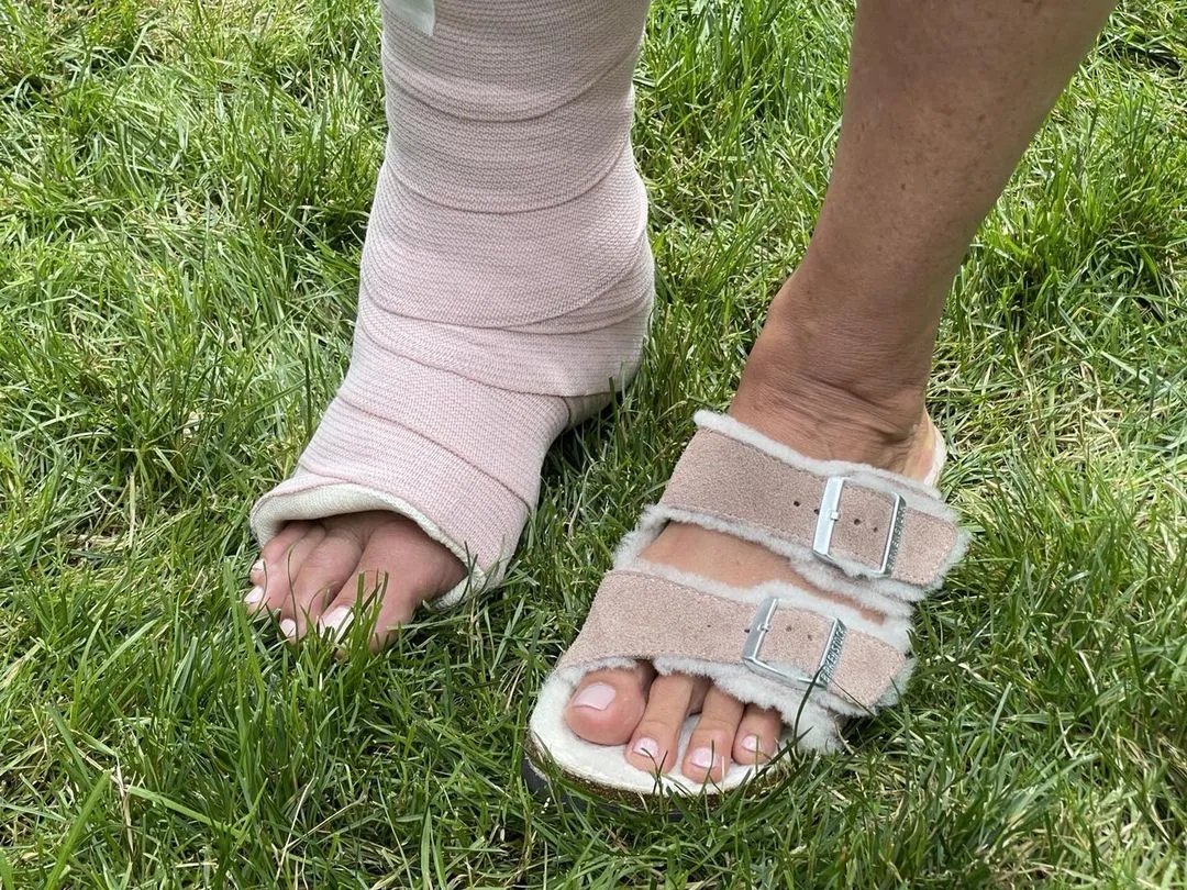 Atriz usa muletas para caminhar em casa