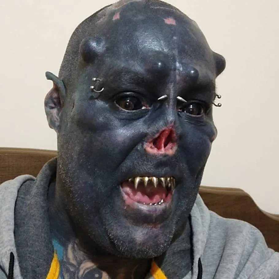 Imagem do tatuador 'Caveira', que removeu a parte externa do nariz