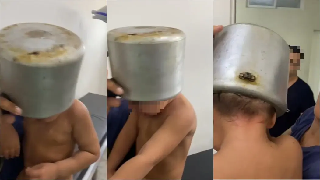 Criança prende a cabeça em panela de pressão durante brincadeira em Granja, no interior do Ceará