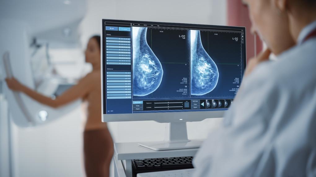 Mulher realiza exame de mamografia