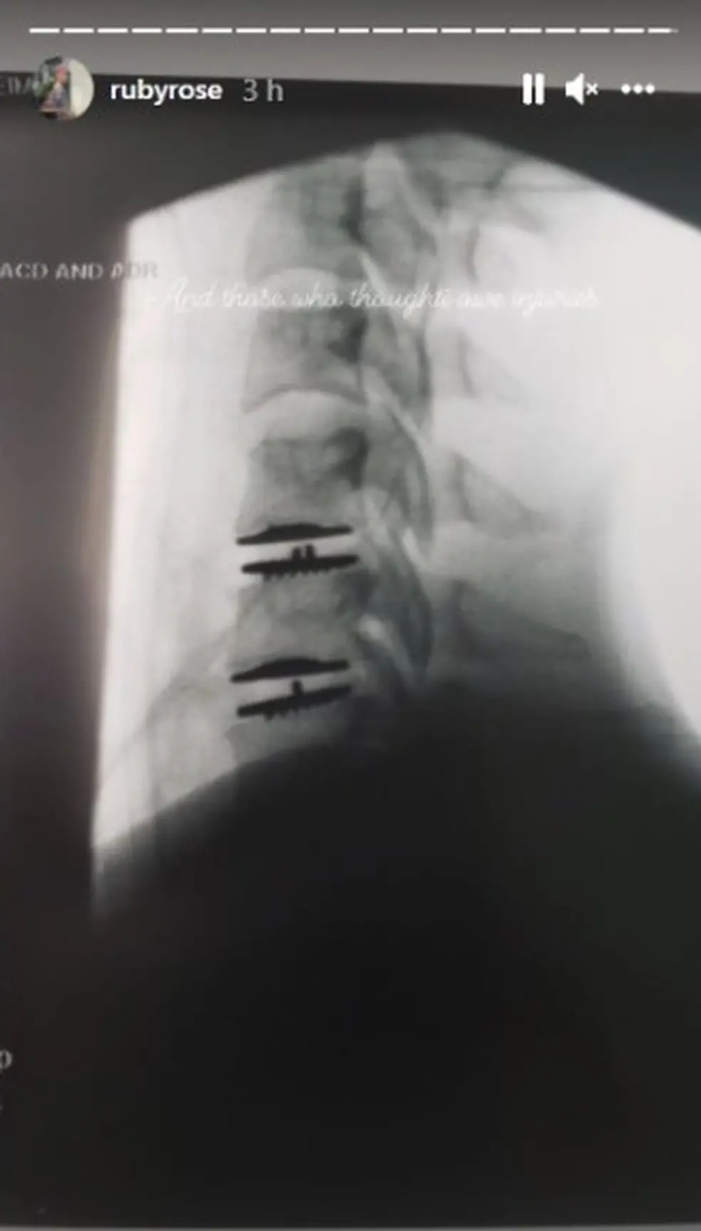 Fraturas mostradas em exames