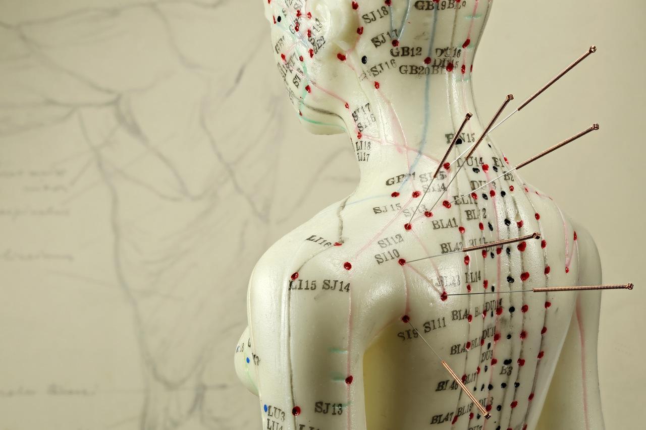 Manequim feminino com pontos de acupuntura marcados com pontos e agulhas