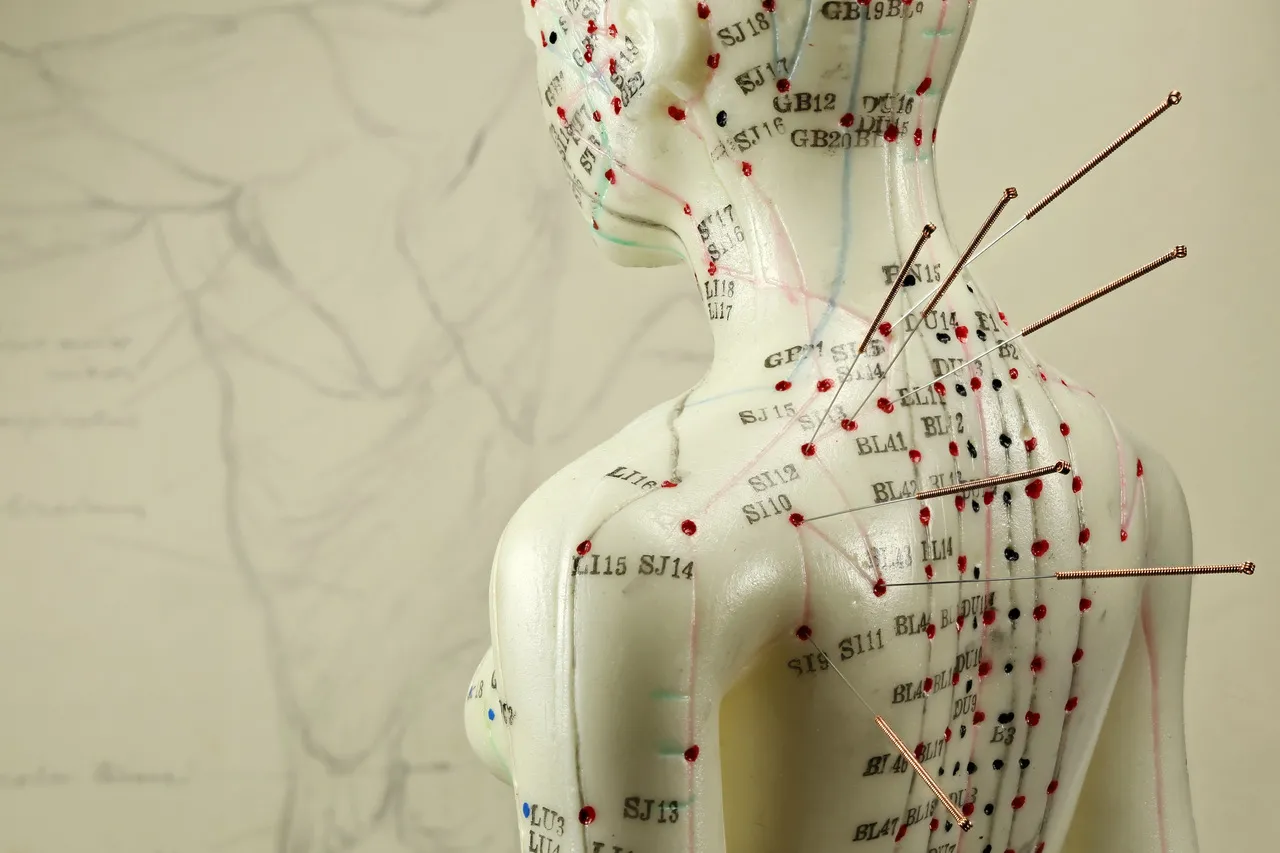 Segundo Mariana Arruda, existem cerca de 72 mil pontos de acupuntura espalhados pelo corpo