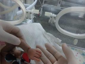 A imagem mostra, principalmente, o bracinho pequeno e magro da bebê Ana Gabriele na UTI pediátrica.
