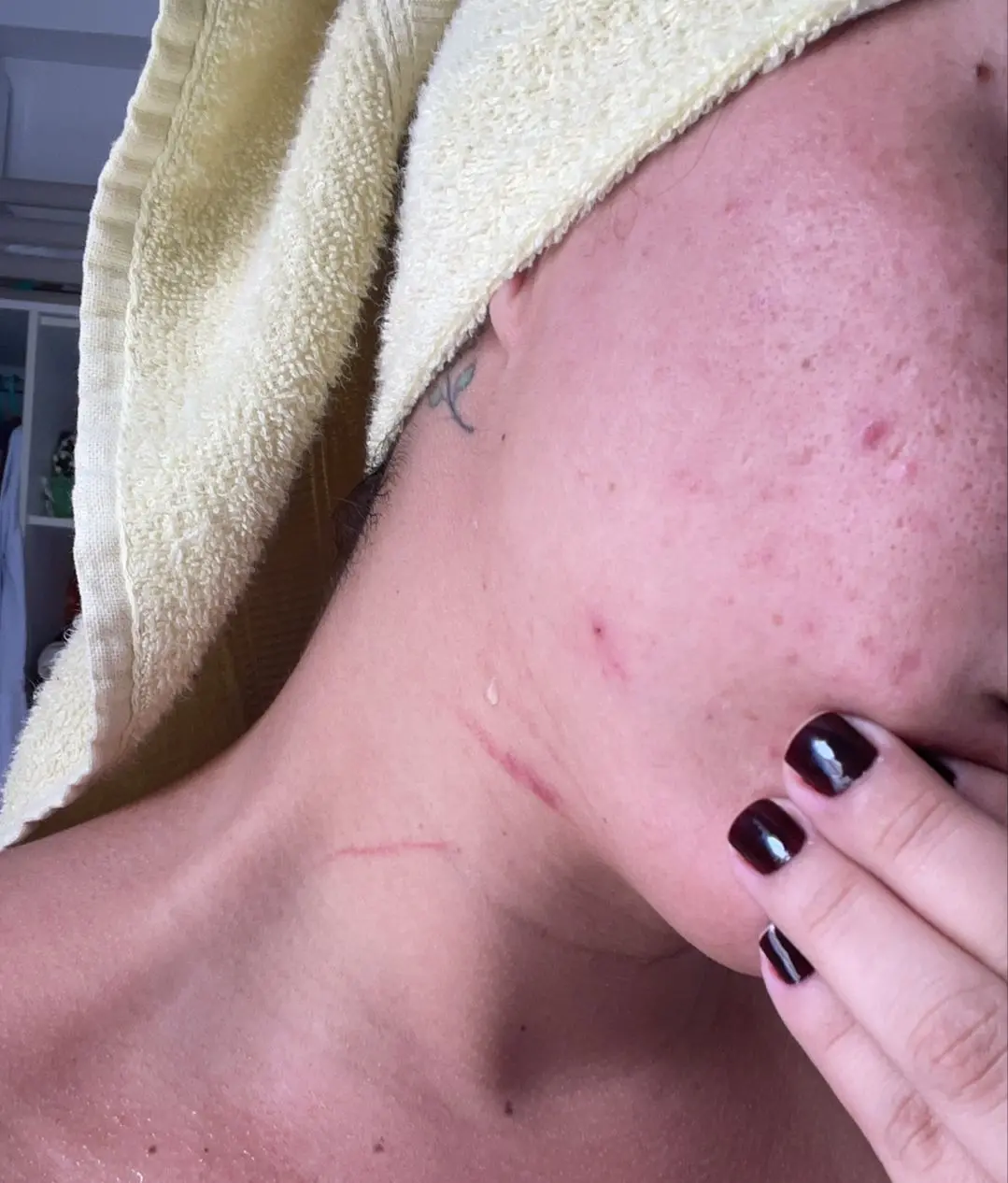 Vítima mostra agressões