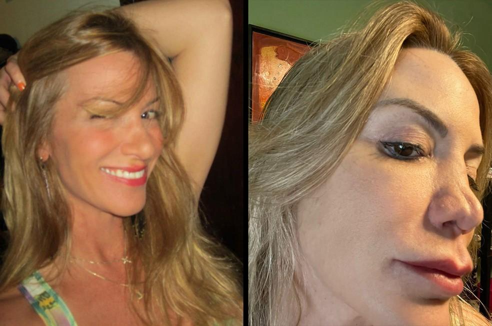 Montagem com foto da vítima antes e depois da cirurgia
