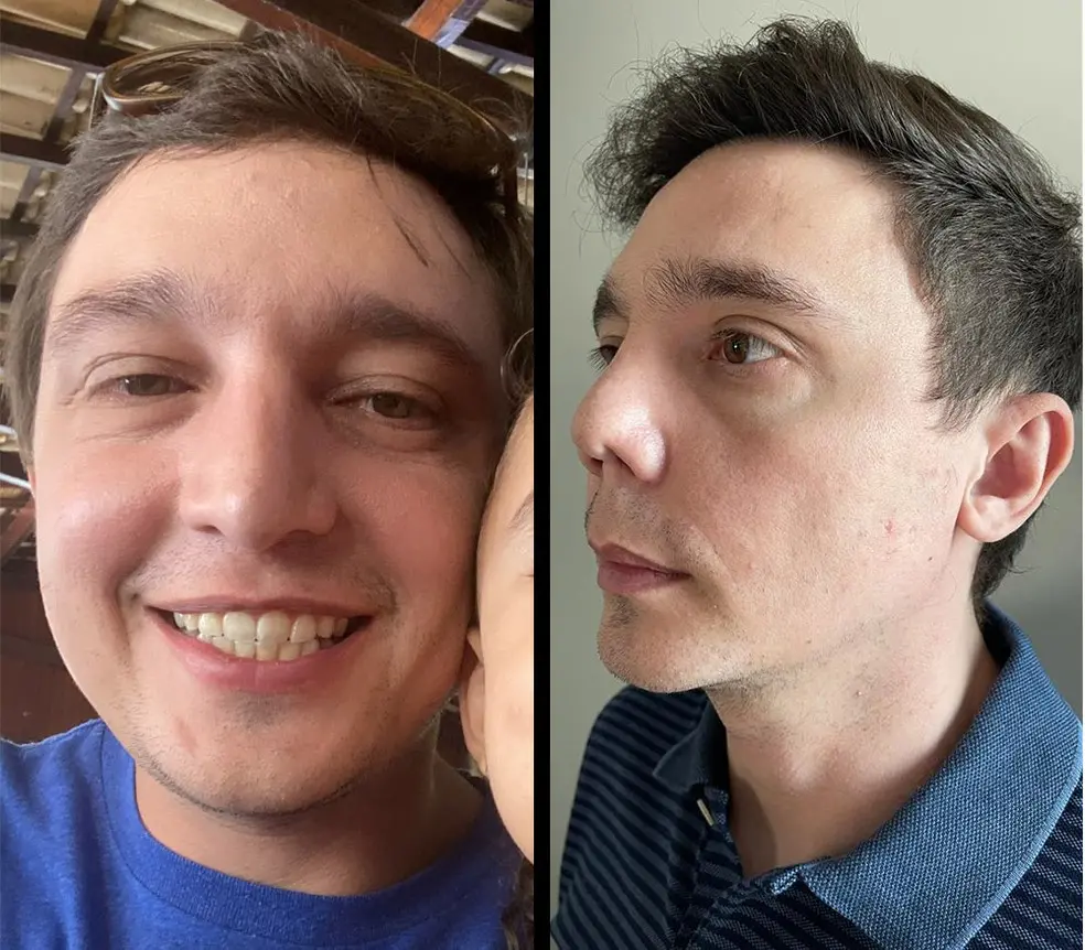 Montagem com fotos do antes e depois do empresário