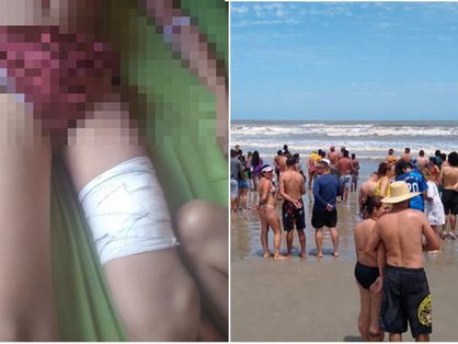 Montagem com praia cheia de pessoas ao redor do garoto após o acidente da perna dele