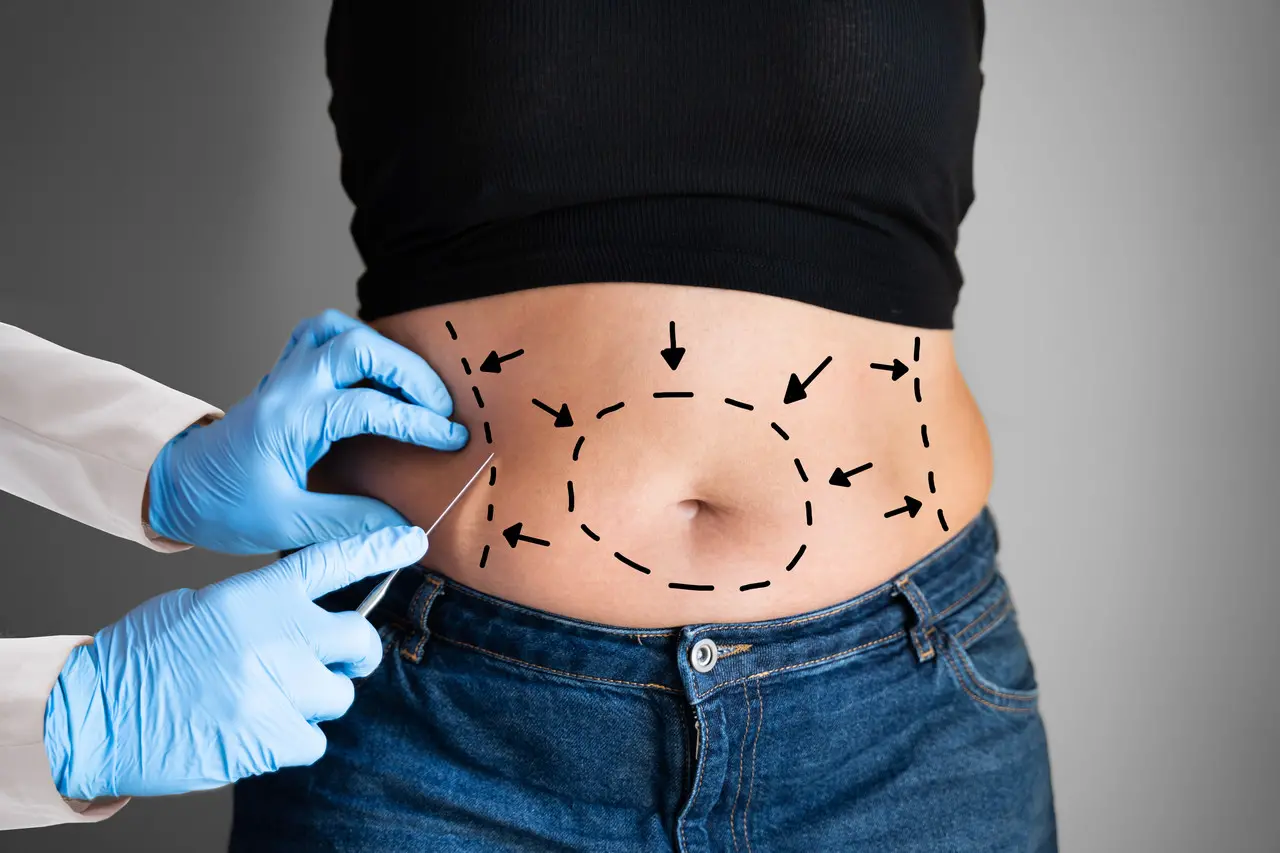 Cirurgião avalia todo o estado geral de saúde e todas as condições pré-existentes de saúde ou fatores de risco do paciente antes de decidir pela abdominoplastia