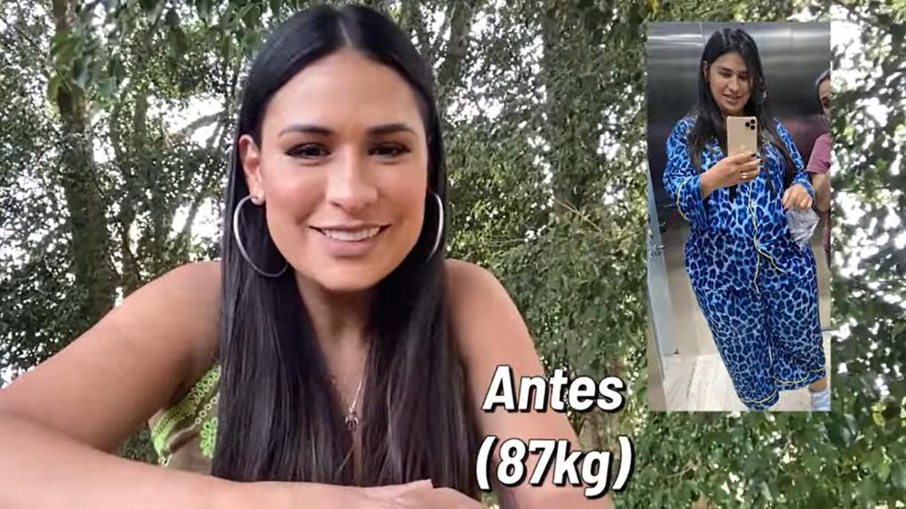 A imagem mostra o antes e o depois da cantora Simone após perder 25 quilos.