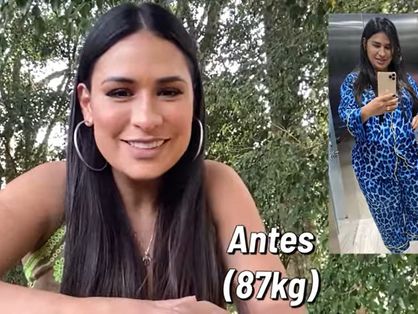 A imagem mostra o antes e o depois da cantora Simone após perder 25 quilos.