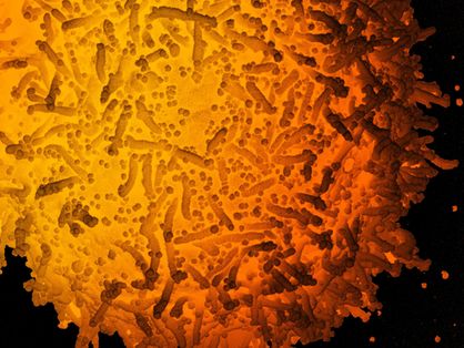 Micrografia eletrônica de varredura com cores aprimoradas de uma célula infectada com partículas de SARS-CoV-2, isolada de uma amostra de paciente. As partículas do vírus SARS-CoV-2 são pequenas estruturas quase esféricas, encontradas na superfície da célula, que exibe projeções celulares alongadas em forma de bastonete.