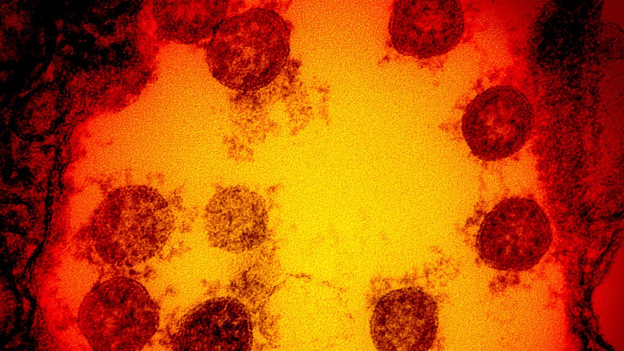 Micrografia eletrônica de transmissão de partículas do vírus SARS-CoV-2, isoladas de um paciente