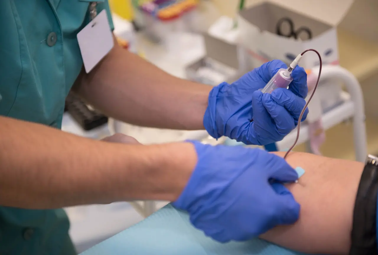 braço de paciente em choque séptico sendo medicado