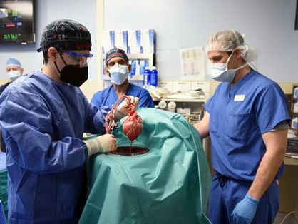 Esta foto divulgada pela Faculdade de Medicina da Universidade de Maryland em 10 de janeiro de 2022 mostra cirurgiões realizando um transplante de coração de um porco geneticamente modificado para o paciente David Bennett