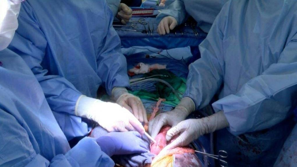 médicos fazendo transplante de rim de porco para humano