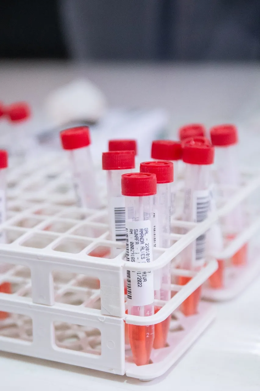 Testagem é ferramenta importante para monitoramento do cenário epidemiológico