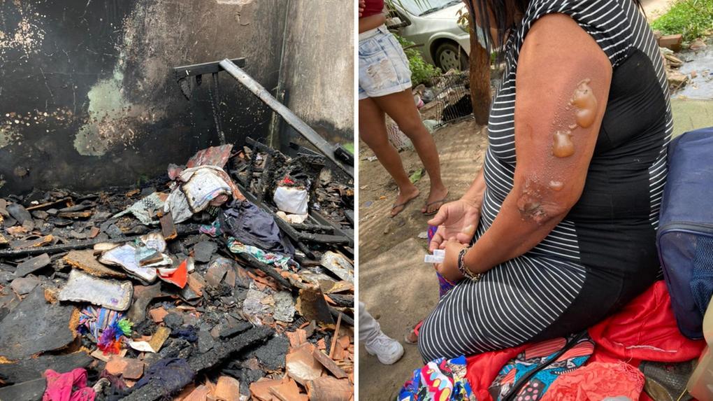 Montagem com imagens de incêndio de atingiu uma residência em Fortaleza e deixou uma mulher com queimadura de segundo grau no braço