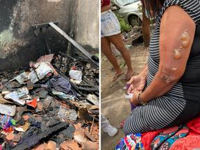 Montagem com imagens de incêndio de atingiu uma residência em Fortaleza e deixou uma mulher com queimadura de segundo grau no braço