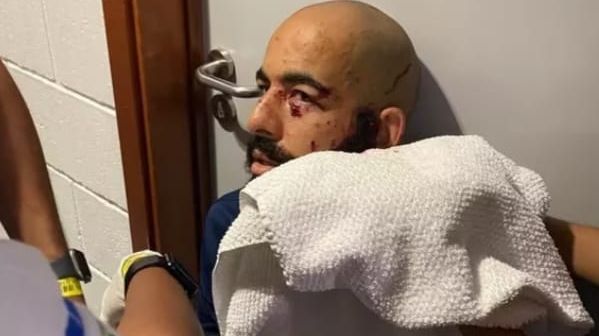 Danilo Fernandes recebe atendimento médico em hospital