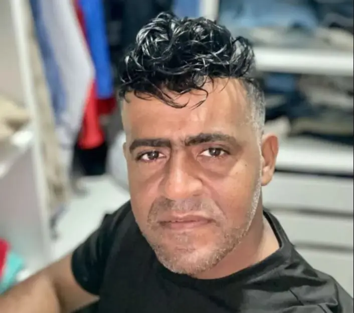 Homem morre durante procedimento de implante capilar na Bahia