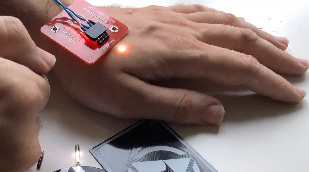 Holandês realiza pagamentos com chip na mão desde 2019.