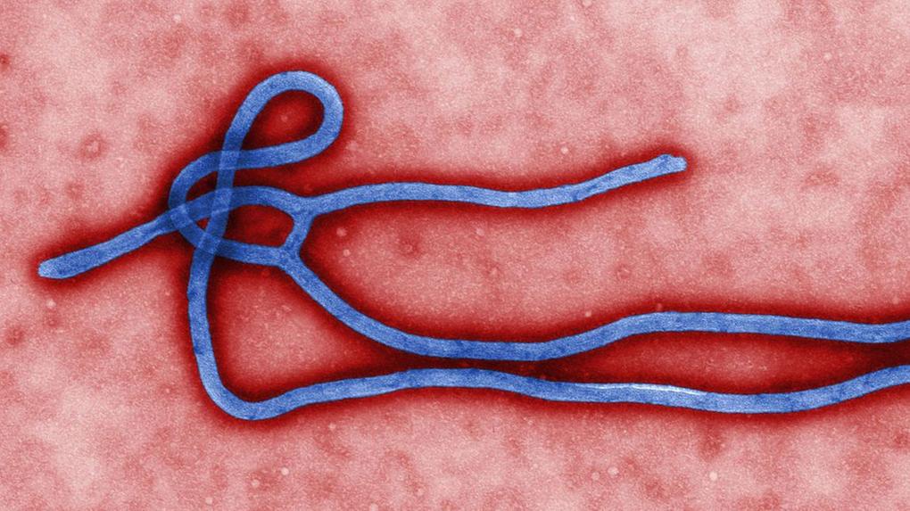 vista microbiológica do vírus da ebola