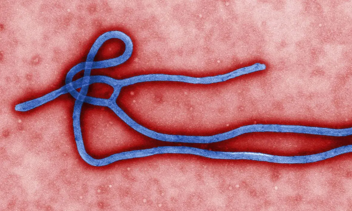 vista microbiológica do vírus da ebola