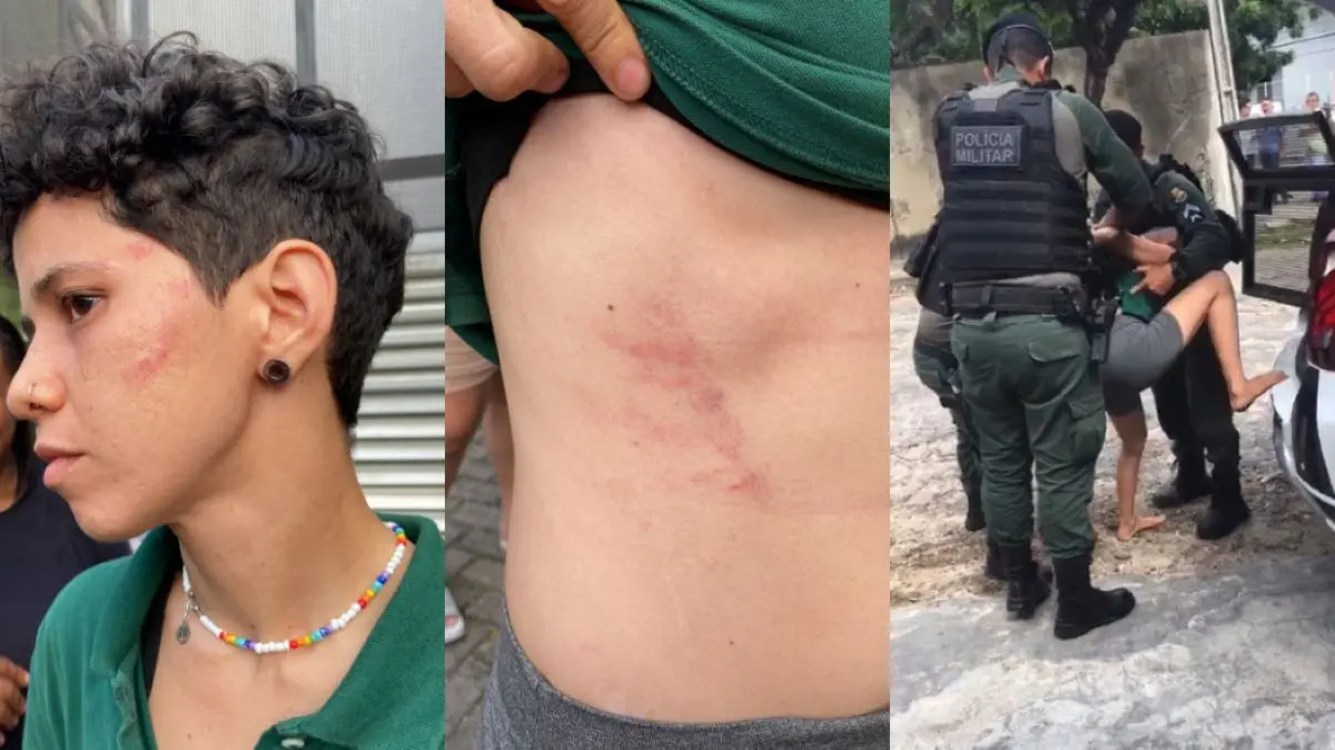 fotos de motorista de aplicativo após agressão