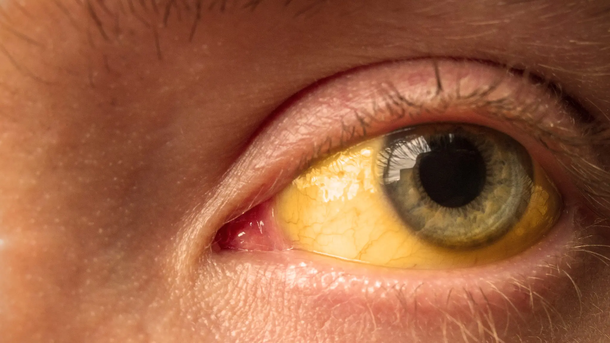 capa da noticia
