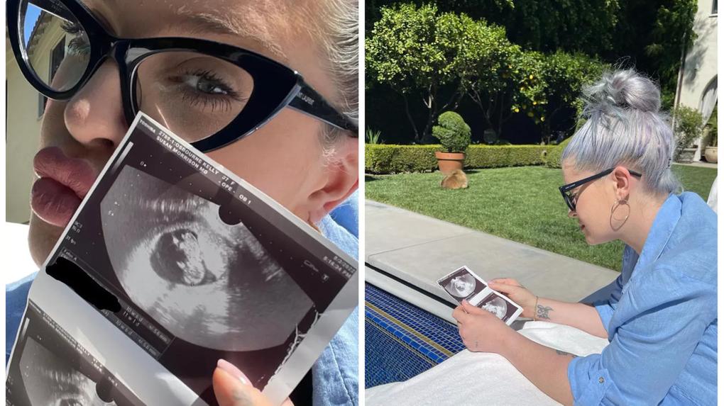 Kelly Osbourne postou fotos com ultrassom de bebê em rede social
