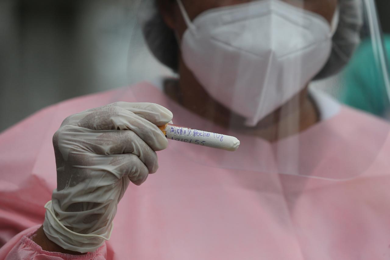 Profissional com máscara e face shield segura amostra de exame de covid