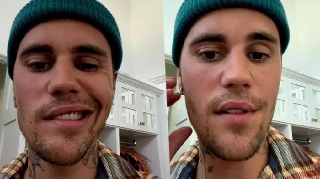 Justin Bieber aparece com rosto paralisado