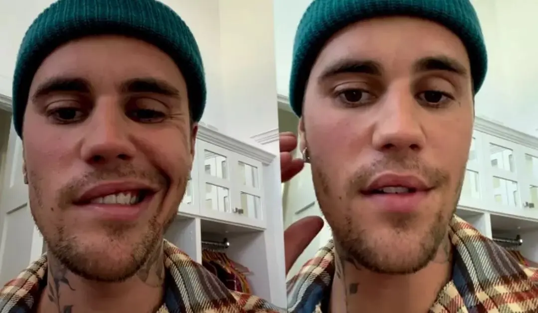Justin Bieber aparece com rosto paralisado