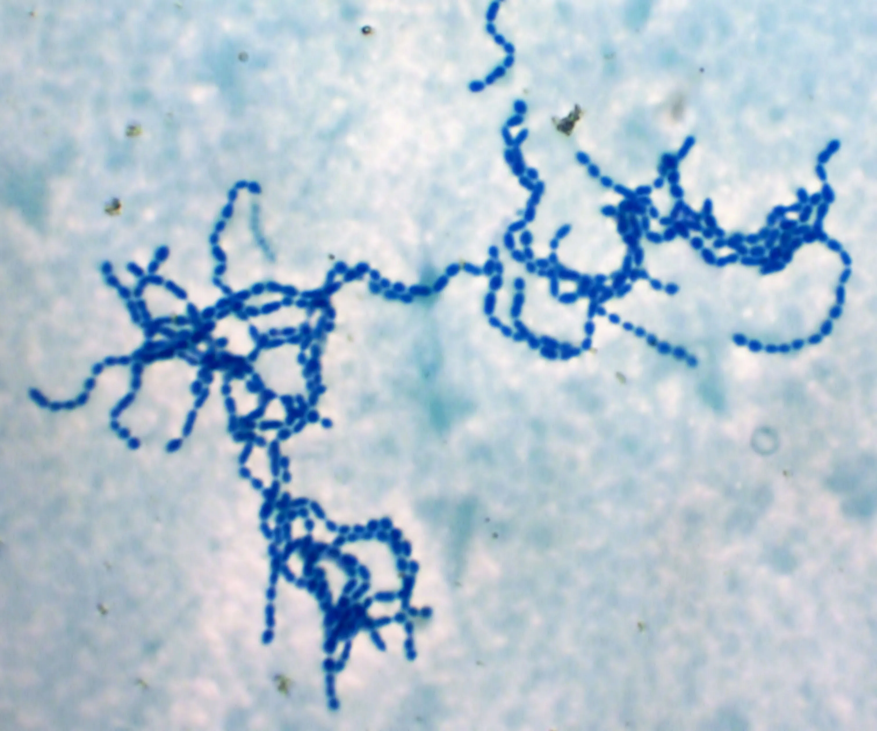 Amigdalite estreptocócica é causada pela bactéria Streptococcus pyogenes