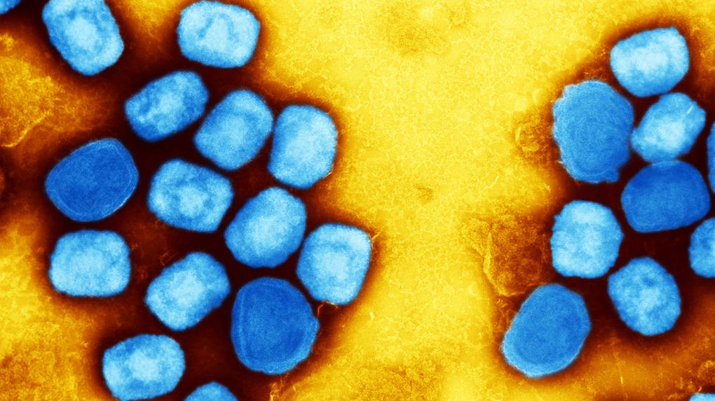 Micrografia electrónica de transmissão colorida de partículas do vírus da varíola dos macacos (azul) cultivadas e purificadas a partir de culturas celulares