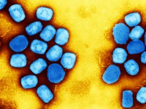 Micrografia electrónica de transmissão colorida de partículas do vírus da varíola dos macacos (azul) cultivadas e purificadas a partir de culturas celulares